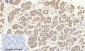 Cytokeratin 18 Polyclonal Antibody