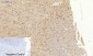 Cytokeratin 18 Polyclonal Antibody