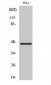 Cytokeratin 18 Polyclonal Antibody