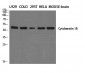 Cytokeratin 18 Polyclonal Antibody