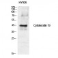 Cytokeratin 19 Polyclonal Antibody