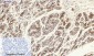 Cytokeratin 19 Polyclonal Antibody