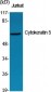 Cytokeratin 5 Polyclonal Antibody