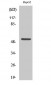 Cytokeratin 7 Polyclonal Antibody