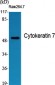 Cytokeratin 7 Polyclonal Antibody