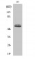 Cytokeratin 8 Polyclonal Antibody