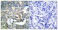 Cytokeratin 8 Polyclonal Antibody