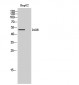 D1DR Polyclonal Antibody