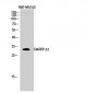 DARPP-32 Polyclonal Antibody