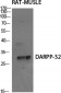 DARPP-32 Polyclonal Antibody