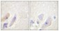 DARPP-32 Polyclonal Antibody
