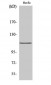 Daxx Polyclonal Antibody