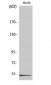 DBP Polyclonal Antibody