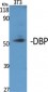 DBP Polyclonal Antibody