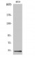 DDX19B Polyclonal Antibody