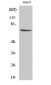 DDX3 Polyclonal Antibody