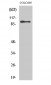 DDX54 Polyclonal Antibody