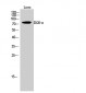 DGK-α Polyclonal Antibody