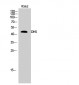 DHS Polyclonal Antibody