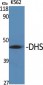 DHS Polyclonal Antibody