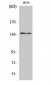 DNA Ligase I Polyclonal Antibody