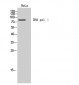 DNA pol ι Polyclonal Antibody