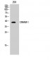 DNAM-1 Polyclonal Antibody