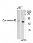 Doublecortin Polyclonal Antibody