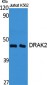 DRAK2 Polyclonal Antibody