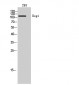 Dsg1 Polyclonal Antibody