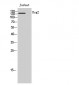 Dsg2 Polyclonal Antibody