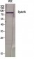 Dyrk1A Polyclonal Antibody