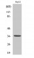 E2F-6 Polyclonal Antibody