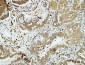 E-cadherin Polyclonal Antibody