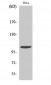 eEF2K Polyclonal Antibody