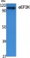 eEF2K Polyclonal Antibody