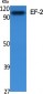 EF-2 Polyclonal Antibody