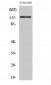 Eg5 Polyclonal Antibody