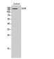 EGFR Polyclonal Antibody