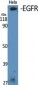 EGFR Polyclonal Antibody