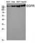 EGFR Polyclonal Antibody