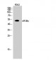 eIF2Bγ Polyclonal Antibody