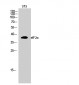 eIF2α Polyclonal Antibody