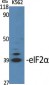 eIF2α Polyclonal Antibody