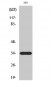 ELOVL6 Polyclonal Antibody