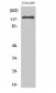 EphB6 Polyclonal Antibody