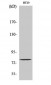 Eps8L1 Polyclonal Antibody