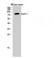 Epsin 1 Polyclonal Antibody