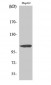 ERAP1 Polyclonal Antibody