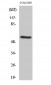 ERβ Polyclonal Antibody